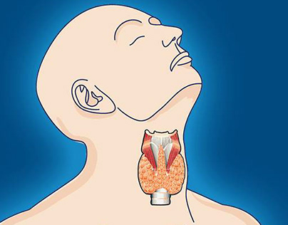 Tiroida Hashimoto – ce nu îți spun analizele clasice